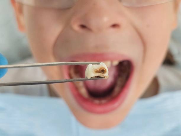 Best Broken Tooth Emergency  in Kenton, TN